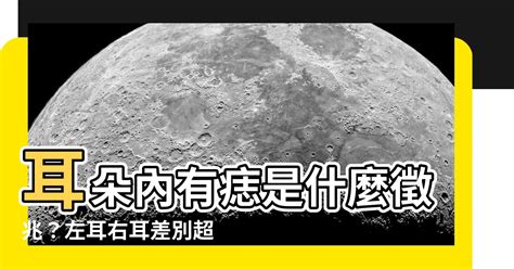 右耳朵突然長痣 農民曆